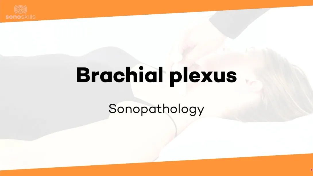 Brachial plexus - sonopathology