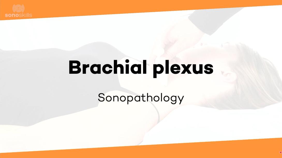 Brachial plexus - sonopathology