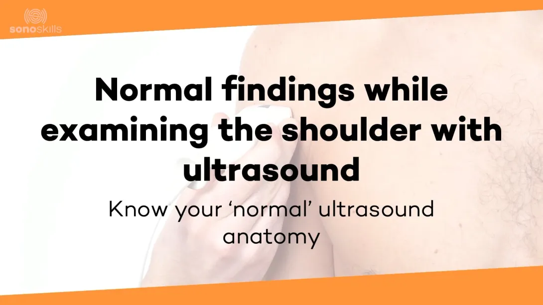 Normal findings ultrasound