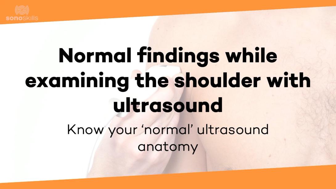Normal findings ultrasound
