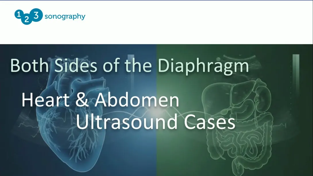 Webinar